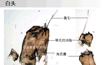夏季男士如何摆脱毛孔粗大