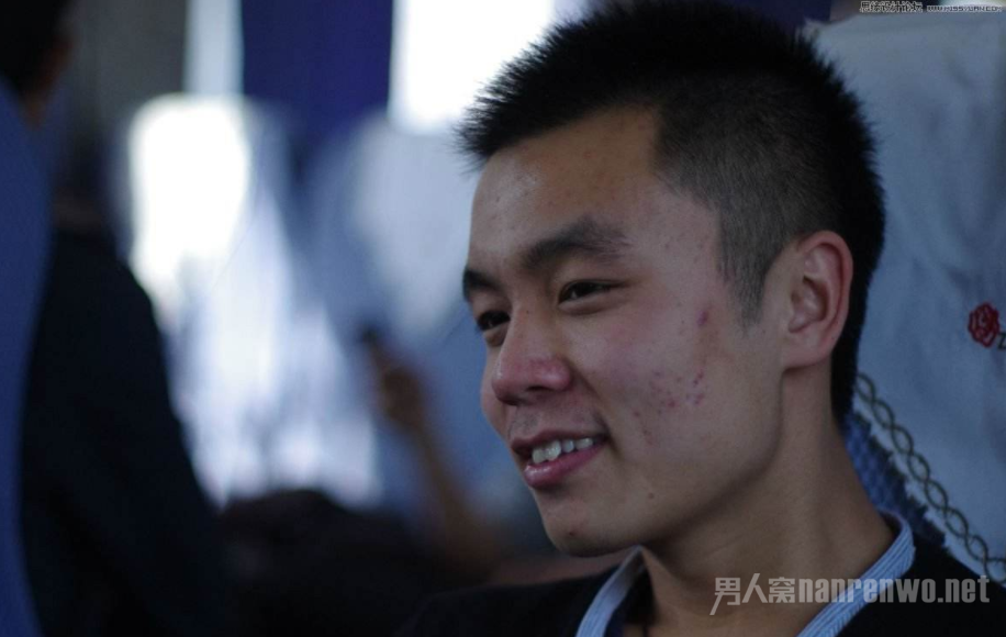 男生祛痘最好的方法 清洗脸上多余的油脂
